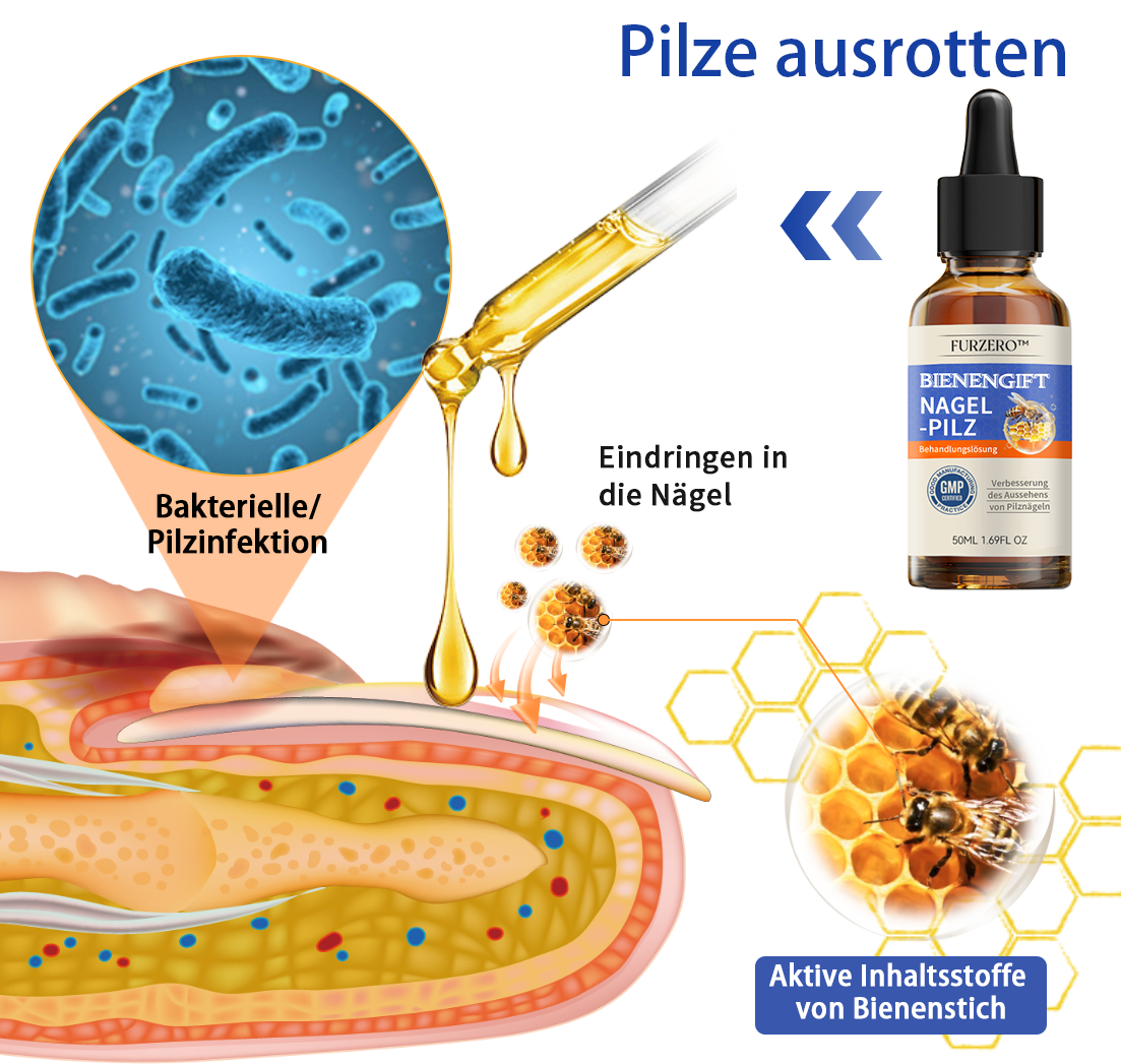 🌟🌟Furzero™ méhméreg körömgomba kezelési megoldás:Teljesen megoldja a körömgomba problémát🐝🐝