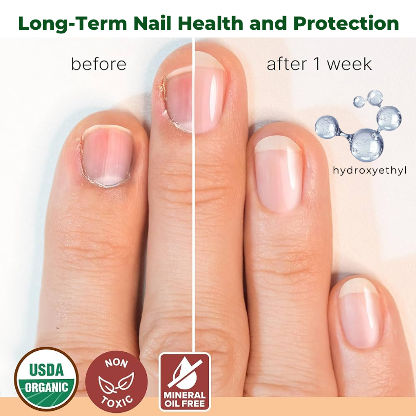 Biancat™ NailNurture Méhméreg Gombakezelő Olaj -👨⚕️ Az Amerikai Bőrgyógyászati Akadémia (AAD) által jóváhagyott termék.