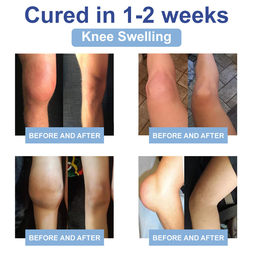 ✅NHS jóváhagyva: (Arthritis, neuropathia, reumatikus betegségek, izomgörcsök, rángások és sportsérülések kezelése)