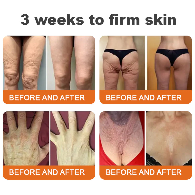 ✨Flysmus™ Botox Méhméreg Firming Szérum Stift🔥UTOLSÓ NAP 70% KEDVEZMÉNY