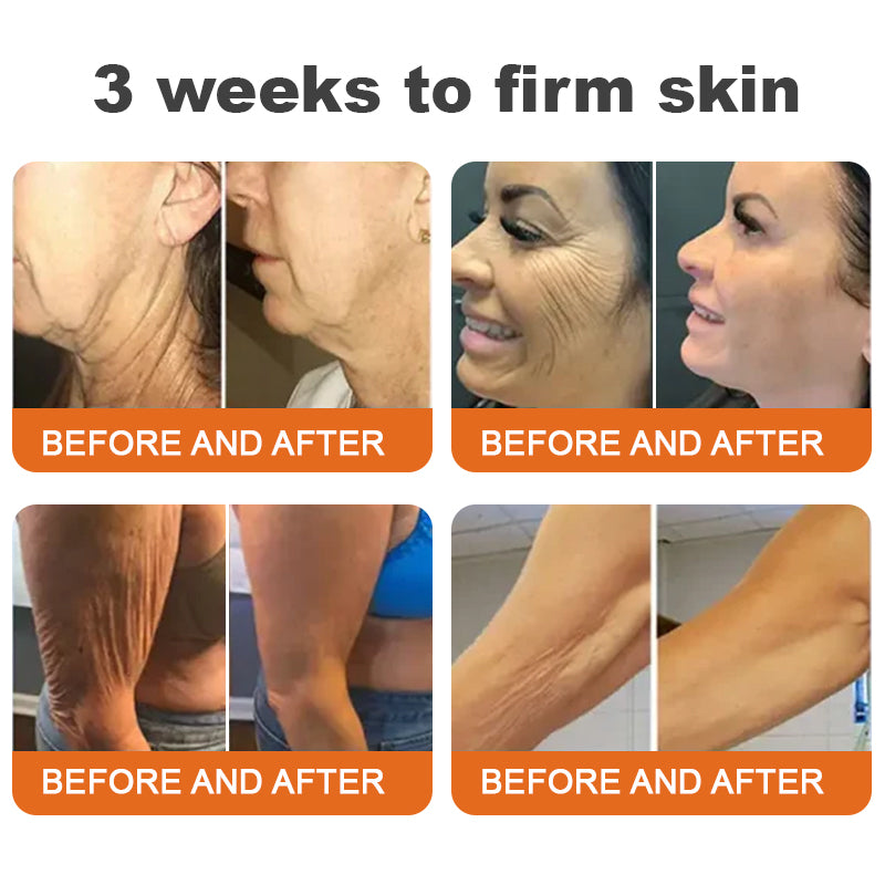 ✨Flysmus™ Botox Méhméreg Firming Szérum Stift🔥UTOLSÓ NAP 70% KEDVEZMÉNY