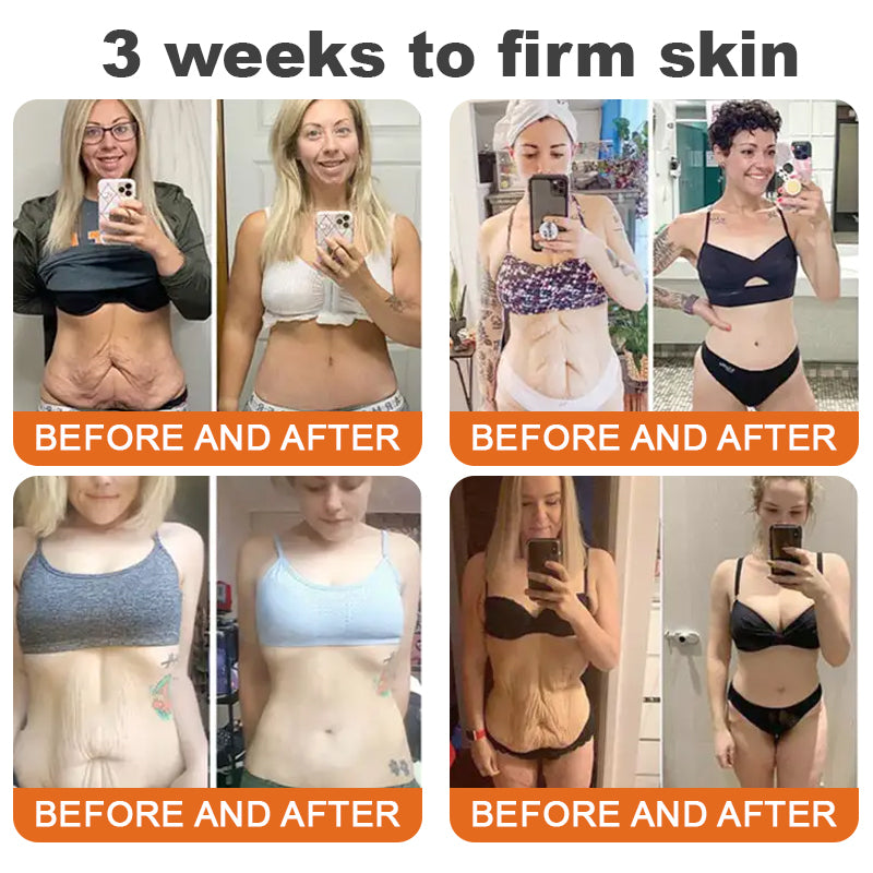 ✨Flysmus™ Botox Méhméreg Firming Szérum Stift🔥UTOLSÓ NAP 70% KEDVEZMÉNY