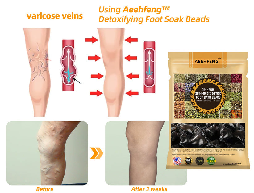 Aeehfeng™ 30 gyógynövényes karcsúsító és méregtelenítő láb - (👩⚕️AVLS tanúsítás)