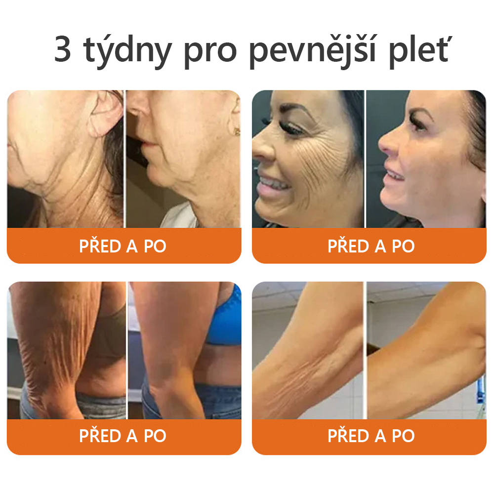 𝐕𝐲𝐫𝐨𝐛𝐞𝐧𝐨 𝐚 𝐨𝐝𝐞𝐬𝐥á𝐧𝐨 𝐯 Č𝐑 🍃𝐃𝐨𝐫𝐦𝐨𝗿𝗻𝗮® 𝐕č𝐞𝐥í 𝐉𝐞𝐝 𝐊𝐨𝐦𝐩𝐥𝐞𝐱𝐧í 𝐤𝐫é𝐦 🌟𝑷𝑶𝑺𝑳𝑬𝑫𝑵Í 𝑫𝑬𝑵 𝑺𝑳𝑬𝑽𝑨 80 %🔥🔥