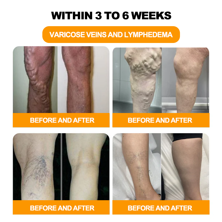 Aeehfeng™ 30 gyógynövényes karcsúsító és méregtelenítő láb - (👩⚕️AVLS tanúsítás)