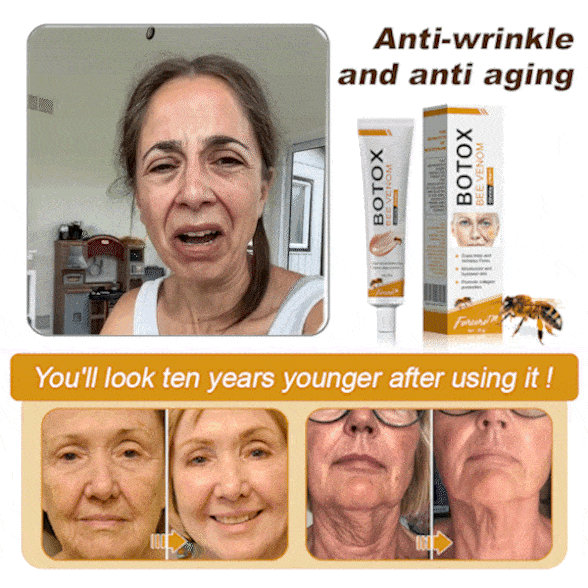 (đżđżKĂ©szĂŒlt Ă©s szĂĄllĂtott az EU-bĂłlâ
) - đ©ââïžFurzeroâą Botox mĂ©hmĂ©reg rĂĄnctalanĂtĂł krĂ©m-(UTOLSĂ NAP 70% LE)