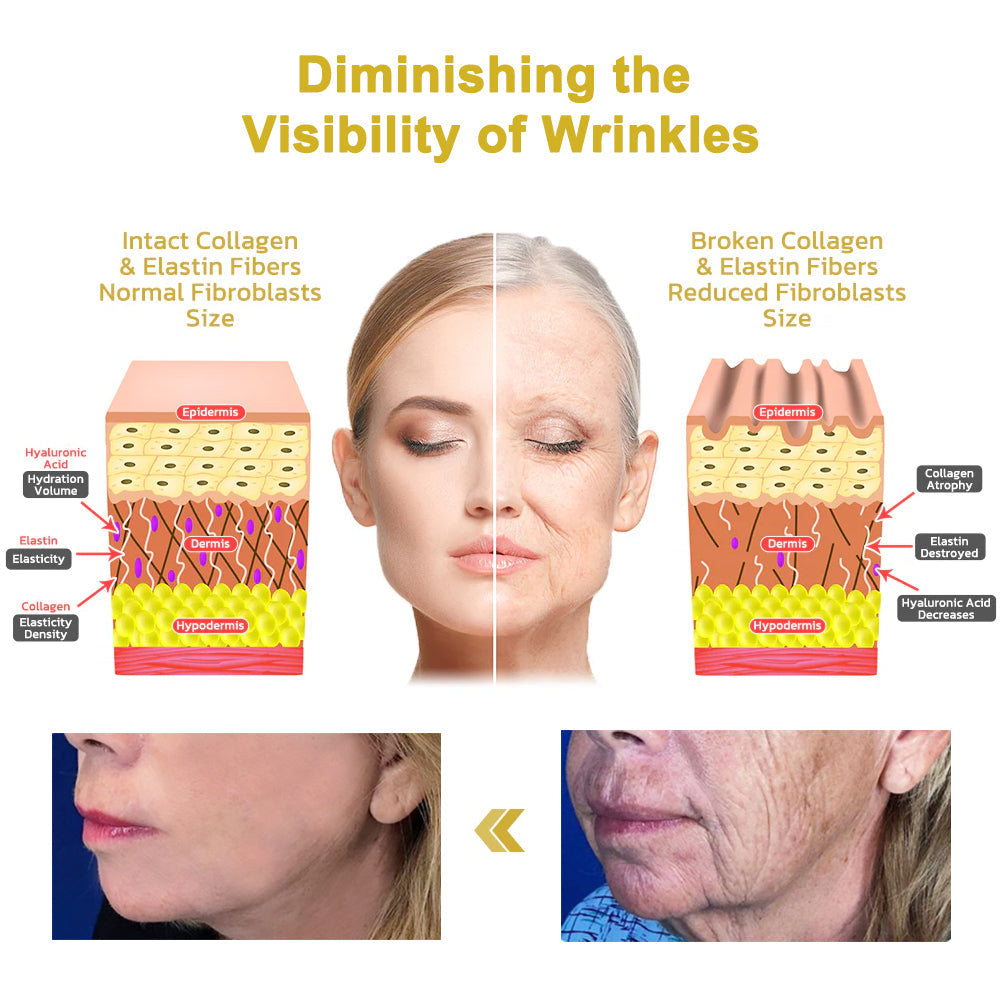 ✨💧Flysmus® Skin Firming Cream,Addressing Crepe & Sagging