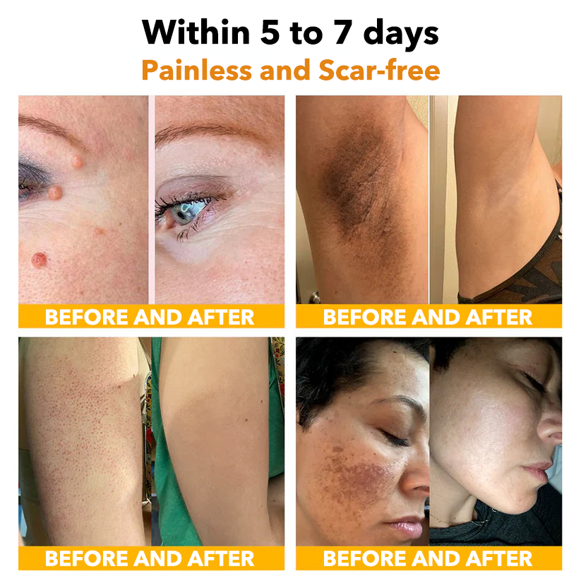 🐝Furzero™ méhméreg terápiás spray(✅Dermatest minősítés)