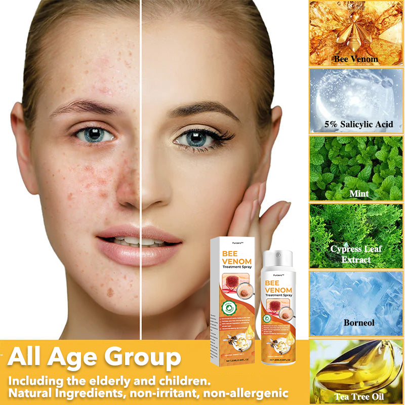 🐝Furzero™ méhméreg terápiás spray(✅Dermatest minősítés)