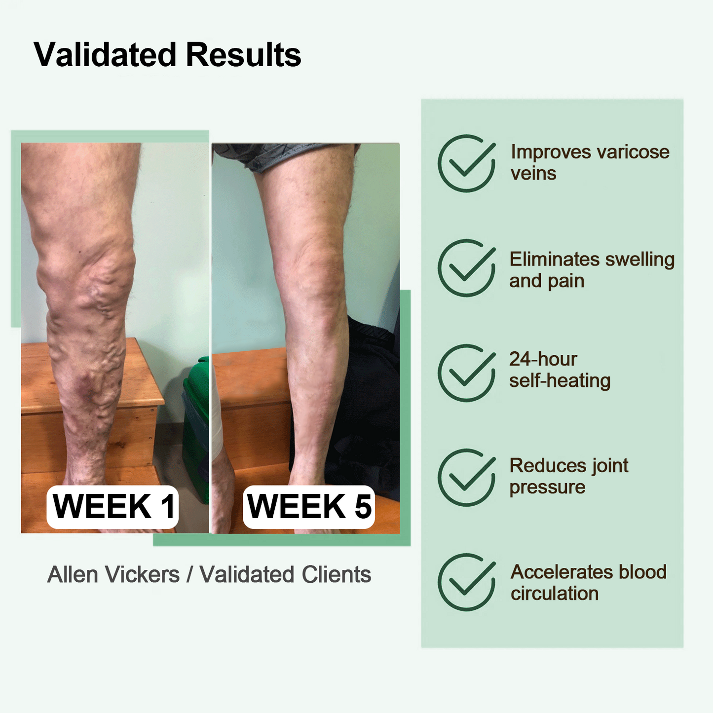 🔥🔥ANYIDEA™ Rádiófrekvenciás gyógynövényes termikus térdtámasz (High Leg Sleeves for Chronic Venous Insufficiency, Spider Veins & Duzzanat)