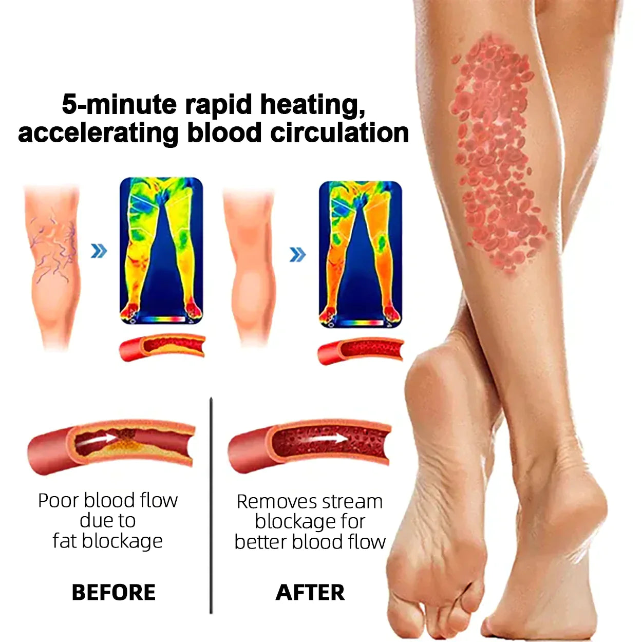 🔥🔥ANYIDEA™ Rádiófrekvenciás gyógynövényes termikus térdtámasz (High Leg Sleeves for Chronic Venous Insufficiency, Spider Veins & Duzzanat)