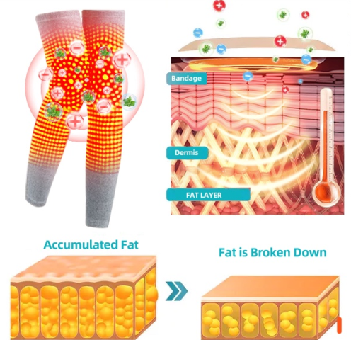🔥🔥ANYIDEA™ Rádiófrekvenciás gyógynövényes termikus térdtámasz (High Leg Sleeves for Chronic Venous Insufficiency, Spider Veins & Duzzanat)