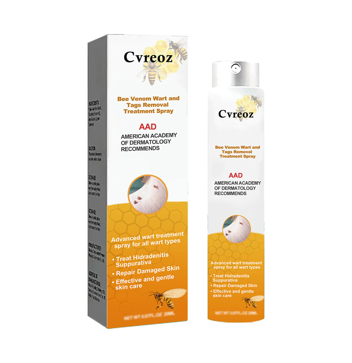 đ§ĄCvreoz Bee Venom mĂ©hmĂ©reg Wart Ă©s cĂmkĂ©k eltĂĄvolĂtĂĄsa kezelĂ©s Spray(đšââAAD AJĂNLJA)đđ(đ„ UtolsĂł napi akciĂł 80% kedvezmĂ©ny)