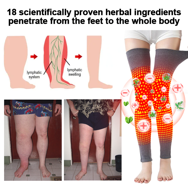 🔥🔥ANYIDEA™ Rádiófrekvenciás gyógynövényes termikus térdtámasz (High Leg Sleeves for Chronic Venous Insufficiency, Spider Veins & Duzzanat)
