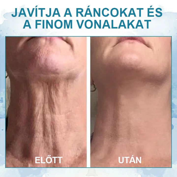 Biancat™ LuxeLift Fiatal vaj a bőr feszességéért