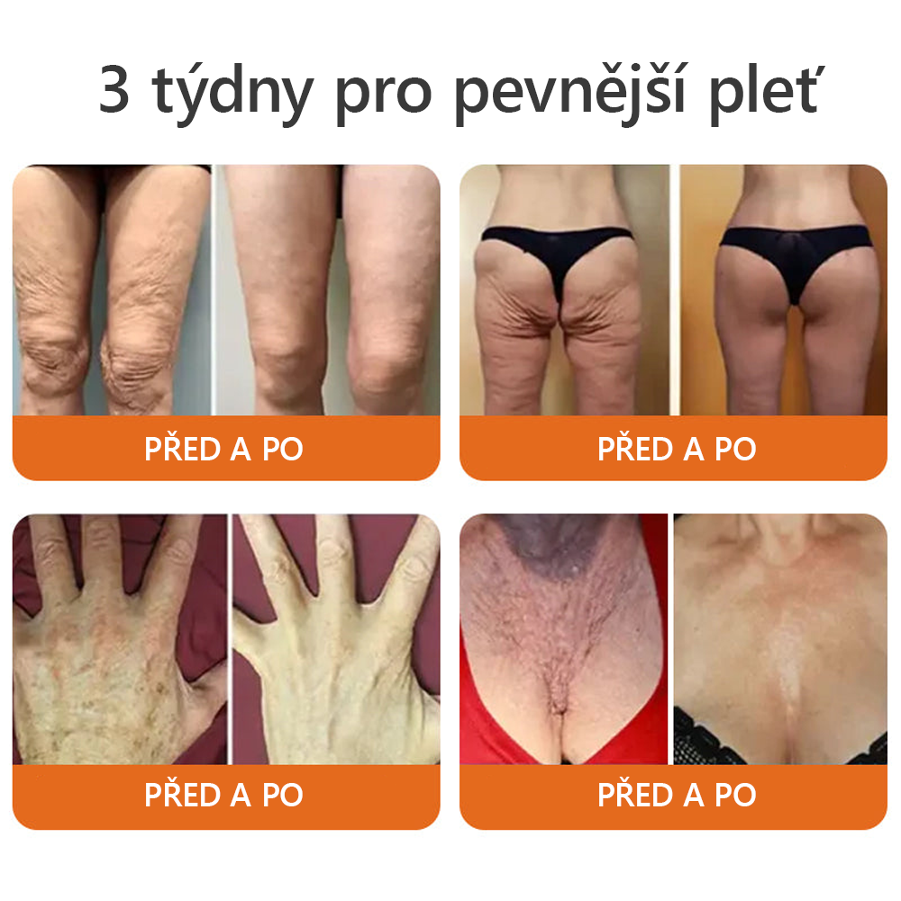 𝐕𝐲𝐫𝐨𝐛𝐞𝐧𝐨 𝐚 𝐨𝐝𝐞𝐬𝐥á𝐧𝐨 𝐯 Č𝐑 🍃𝐃𝐨𝐫𝐦𝐨𝗿𝗻𝗮® 𝐕č𝐞𝐥í 𝐉𝐞𝐝 𝐊𝐨𝐦𝐩𝐥𝐞𝐱𝐧í 𝐤𝐫é𝐦 🌟𝑷𝑶𝑺𝑳𝑬𝑫𝑵Í 𝑫𝑬𝑵 𝑺𝑳𝑬𝑽𝑨 80 %🔥🔥