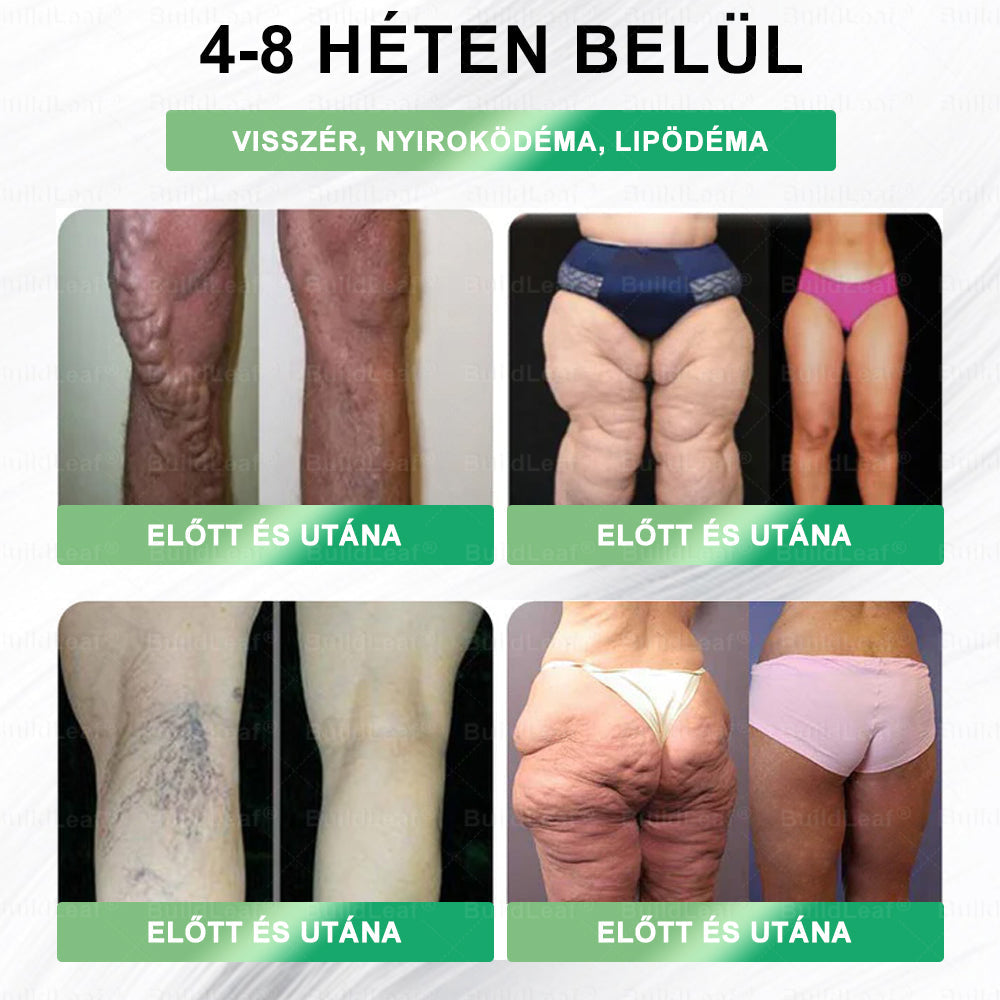 🏥A Szófiai Orvostudományi Egyetemi Kórház ajánlásai | hivatalos bolt | 🍀𝑆𝑇𝐷𝘌𝘐® 𝐺𝐿𝑃-1 Fogyás Orális oldat -👨‍⚕️Elhízás, szív- és érrendszeri betegségek, cukorbetegség, alvási apnoe, ízületi problémák és egyéb