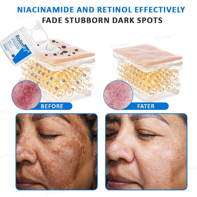 ✨✨💧(Ausztráliában gyártva és onnan szállítva)✨Rolimey® Advanced Firming & Wrinkle-Reducing Cream (SPF 50+ fényvédővel)✨UTOLSÓ NAP 60% KEDVEZMÉNY