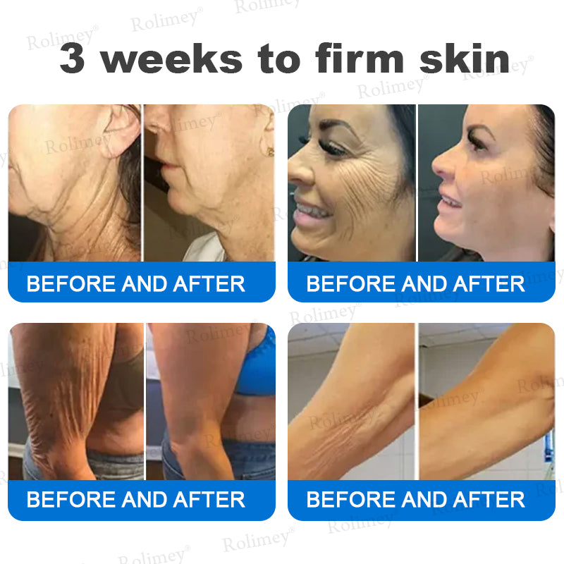 ✨✨💧(Ausztráliában gyártva és onnan szállítva)✨Rolimey® Advanced Firming & Wrinkle-Reducing Cream (SPF 50+ fényvédővel)✨UTOLSÓ NAP 60% KEDVEZMÉNY