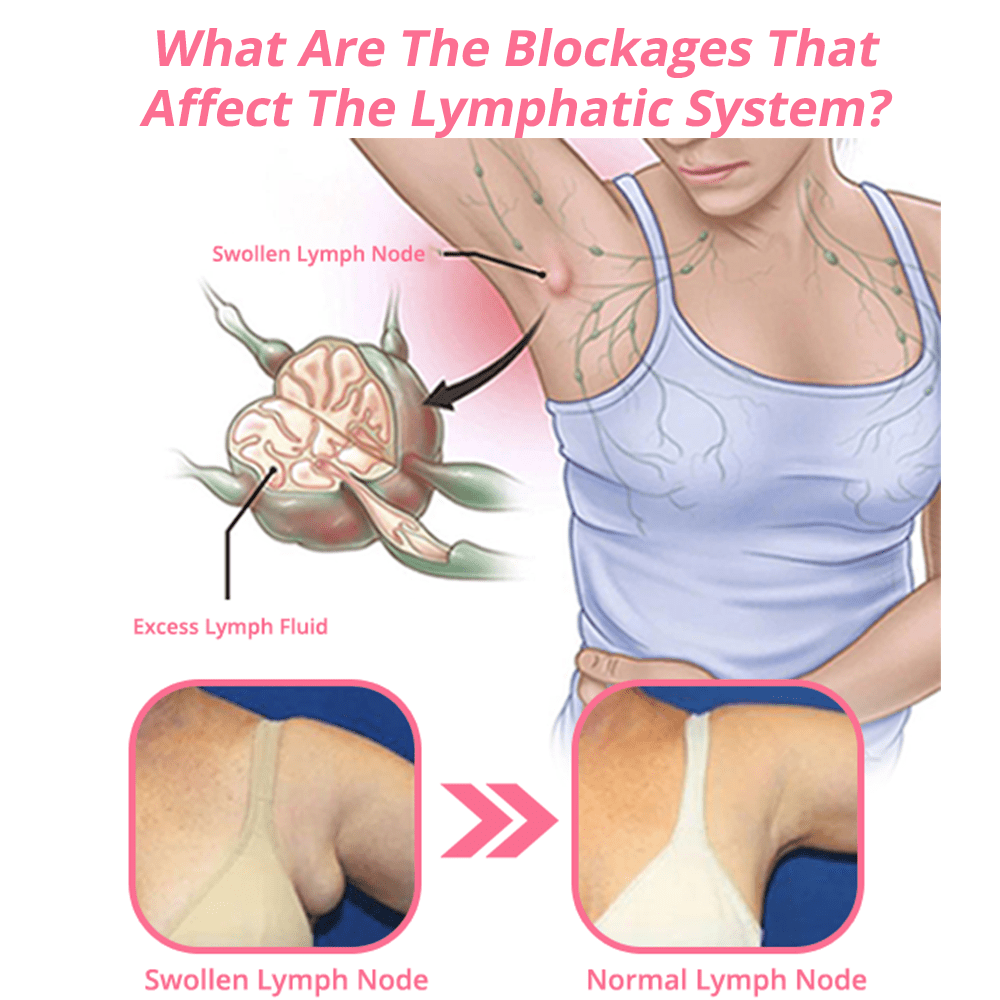 flysmus™ Lymphvity MagneTherapy Germanium fülbevaló