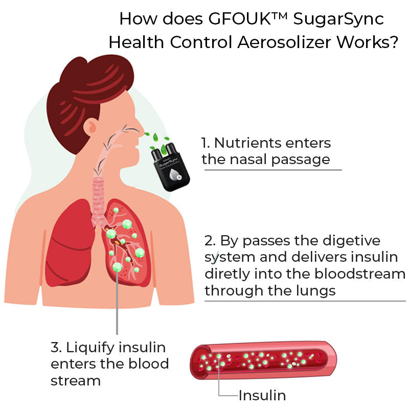 GFOUK™ SugarSync Egészség  Ellenőrzés Aeroszolizáló